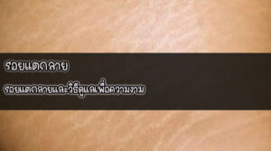 รอยแตกลาย